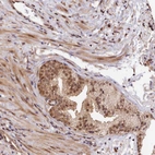 Immunohistochemical staining of human prostate shows moderate to strong cytoplasmic positivity in glandular cells.