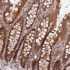 Immunohistochemical staining of human colon shows moderate to strong cytoplasmic positivity in glandular cells.