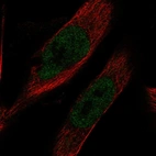 Immunofluorescent staining of human cell line U-251 MG shows localization to nucleoplasm.