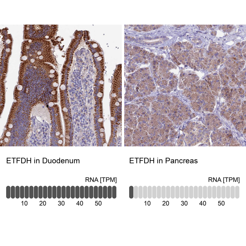Anti-ETFDH Antibody