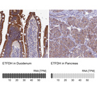 Anti-ETFDH Antibody
