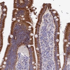 Immunohistochemical staining of human duodenum shows high expression.