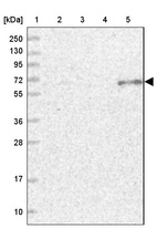 Lane 1: Marker [kDa] 250, 130, 95, 72, 55, 36, 28, 17, 10_br/_Lane 2: Human cell line RT-4_br/_Lane 3: Human cell line U-251MG sp_br/_Lane 4: Human plasma (IgG/HSA depleted)_br/_Lane 5: Human liver tissue