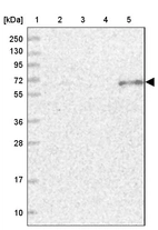 Lane 1: Marker [kDa] 250, 130, 95, 72, 55, 36, 28, 17, 10_br/_Lane 2: Human cell line RT-4_br/_Lane 3: Human cell line U-251MG sp_br/_Lane 4: Human plasma (IgG/HSA depleted)_br/_Lane 5: Human liver tissue