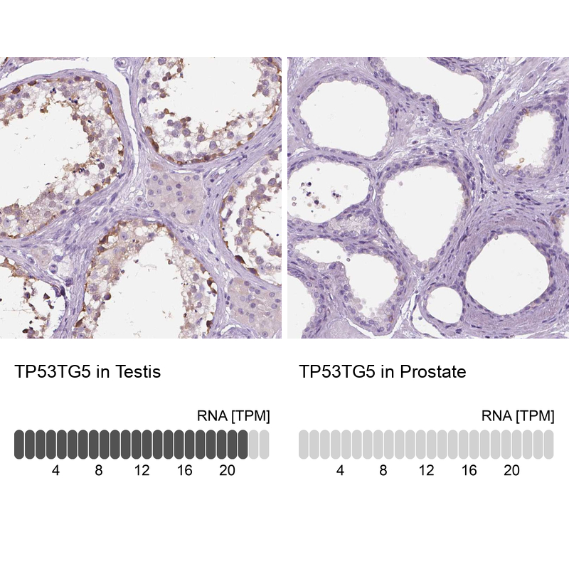 Anti-TP53TG5 Antibody