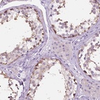 Immunohistochemical staining of human testis shows high expression.
