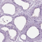 Immunohistochemical staining of human prostate shows low expression as expected.