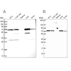 Western blot analysis using Anti-SDHA antibody HPA041981 (A) shows similar pattern to independent antibody HPA064582 (B).