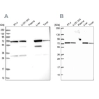 Western blot analysis using Anti-SDHA antibody HPA041981 (A) shows similar pattern to independent antibody HPA064582 (B).