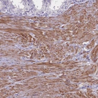 Anti-HEATR3 Antibody