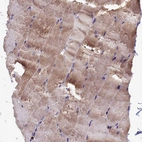 Immunohistochemical staining of human skeletal muscle shows moderate cytoplasmic positivity in myocytes.