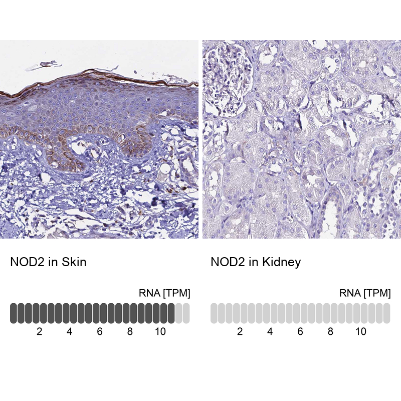 Anti-NOD2 Antibody