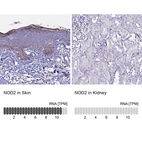 Anti-NOD2 Antibody
