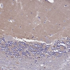 Immunohistochemical staining of human cerebellum shows no positivity in Purkinje cells as expected.