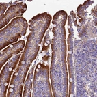 Immunohistochemical staining of human duodenum shows strong cytoplasmic positivity in glandular cells.