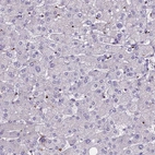 Immunohistochemical staining of human liver shows no positivity in hepatocytes as expected.