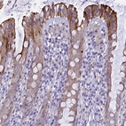 Immunohistochemical staining of human rectum shows strong cytoplasmic positivity in glandular cells.