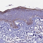 Immunohistochemical staining of human skin shows moderate to strong cytoplasmic positivity in keratinocytes.