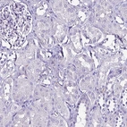Immunohistochemical staining of human kidney shows no positivity in cells in tubules as expected.
