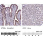 Anti-MRC2 Antibody
