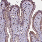 Immunohistochemical staining of human Gallbladder shows strong membranous positivity in glandular cells.
