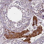Immunohistochemical staining of human Testis shows strong cytoplasmic positivity in Leydig cells.