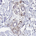 Immunohistochemical staining of human Breast shows strong membranous positivity in myoepithelial cells.