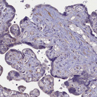 Immunohistochemical staining of human Placenta shows weak cytoplasmic positivity in endothelial cells.