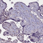 Immunohistochemical staining of human Placenta shows weak cytoplasmic positivity in endothelial cells.