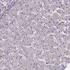 Immunohistochemical staining of human Liver shows very weak membranous positivity in hepatocytes.