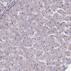 Immunohistochemical staining of human Liver shows very weak membranous positivity in hepatocytes.