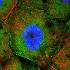 Immunofluorescent staining of human cell line A-431 shows localization to plasma membrane & cytosol.