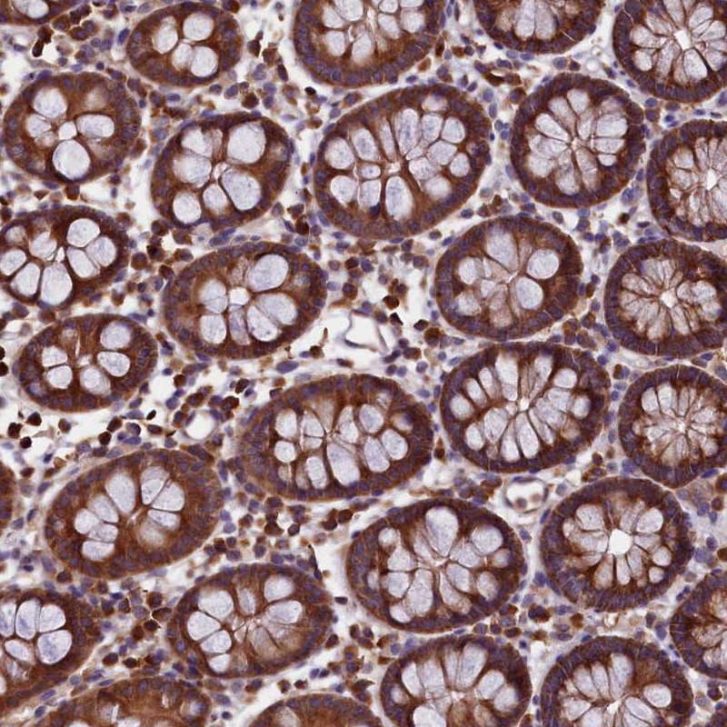 Anti-EIF3G Antibody