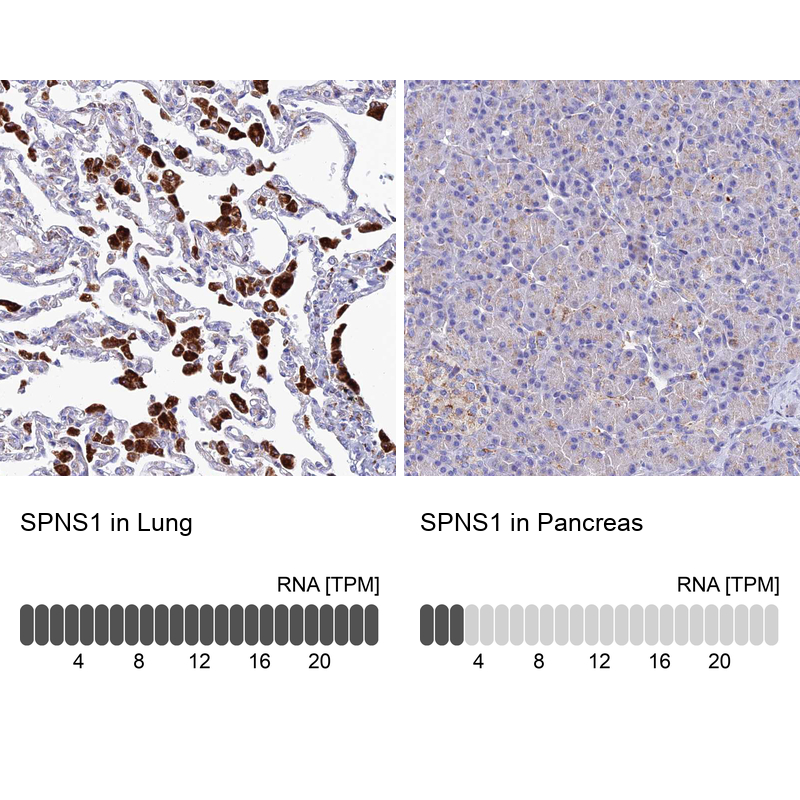 Anti-SPNS1 Antibody