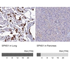 Anti-SPNS1 Antibody