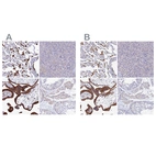 Immunohistochemical staining of human lung, pancreas, placenta and testis using Anti-SPNS1 antibody HPA041995 (A) shows similar protein distribution across tissues to independent antibody HPA042988 (B).