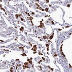Immunohistochemical staining of human lung shows strong granular cytoplasmic positivity in macrophages.