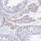 Immunohistochemical staining of human testis shows weak granular cytoplasmic positivity in Leydig cells.