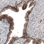 Immunohistochemical staining of human prostate shows moderate to strong cytoplasmic positivity in glandular cells.