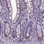 Immunohistochemical staining of human small intestine shows strong cytoplasmic positivity in lymphoid cells.