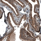 Immunohistochemical staining of human fallopian tube shows moderate to strong cytoplasmic positivity in glandular cells.