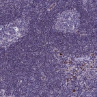 Immunohistochemical staining of human lymph node shows strong cytoplasmic positivity in a small subset of lymphoid cells.