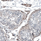 Immunohistochemical staining of human testis shows moderate cytoplasmic positivity in Leydig cells and very weak cytoplasmic positivity in cells in seminiferous ducts.