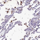 Immunohistochemical staining of human lung shows moderate cytoplasmic positivity in macrophages.