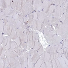 Immunohistochemical staining of human skeletal muscle shows no positivity in myocytes as expected.