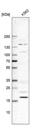 Western blot analysis in human cell line K562.