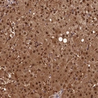 Anti-ACP7 Antibody