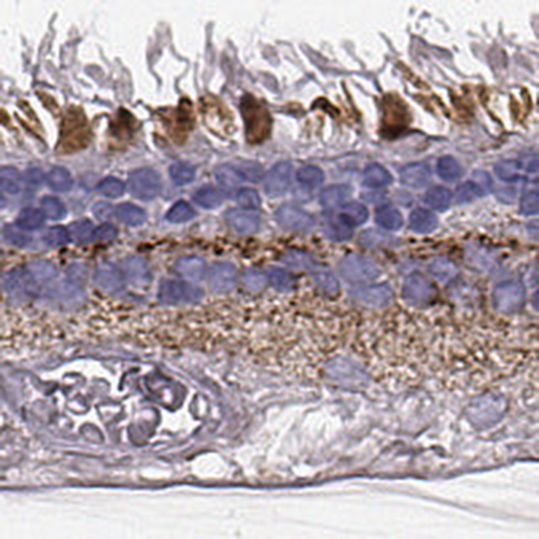 Anti-RDH13 Antibody
