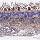 Anti-RDH13 Antibody