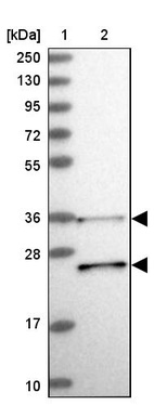 Anti-RDH13 Antibody